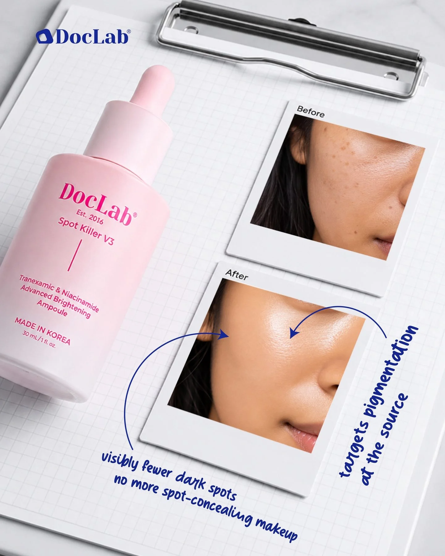 Before and after photos on a clipboard: visibly fewer dark spots, no more spot-concealing makeup. Targets pigmentation at the source.