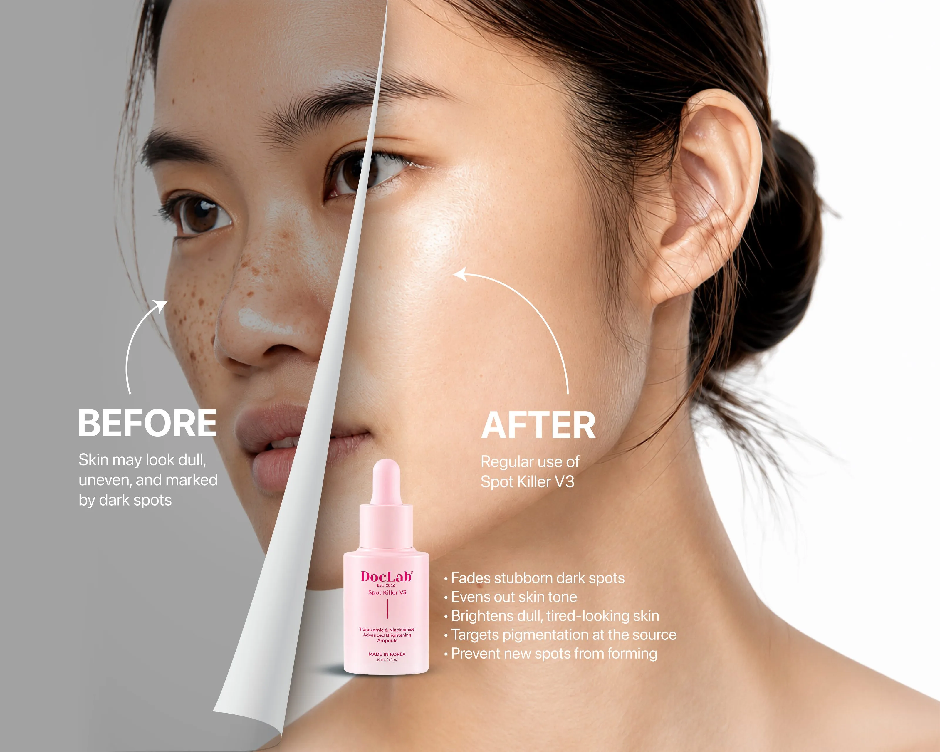 Before: skin may look dull, uneven and marked by dark spots. After: regular use of Spot Killer V3. Fades stubborn dark spots, evens out skin tone, brightens dull, tired-looking skin, targets pigmentation at the source, prevents new spots from forming.
