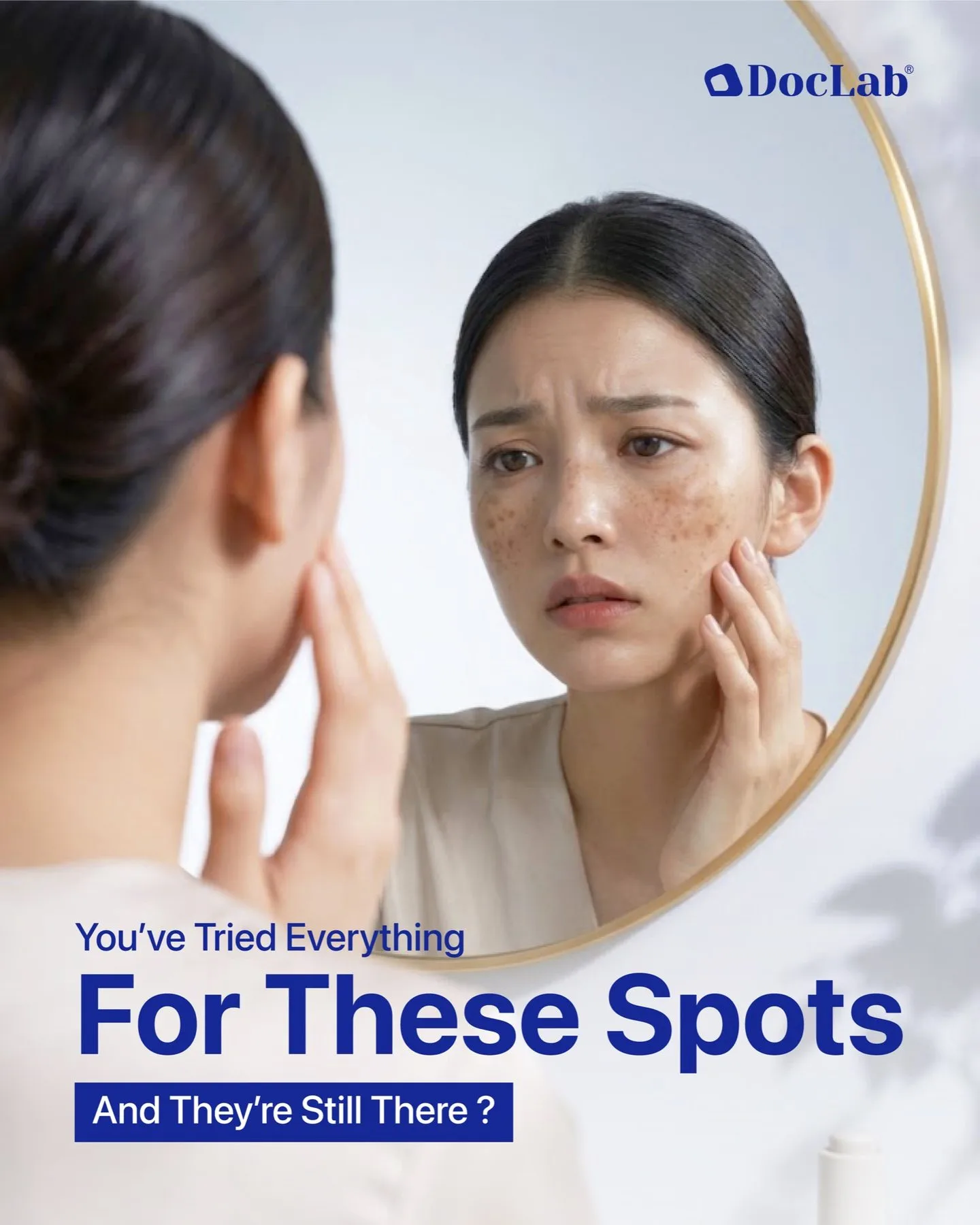 You've tried everything for these spots, and they're still there?