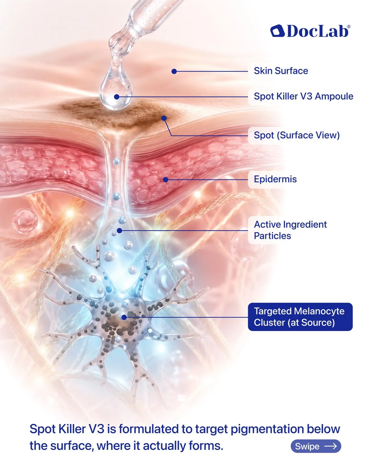 Diagram of the skin: Spot Killer V3 ampoule passes the skin surface and epidermis to the melanocyte cluster at the source. Spot Killer V3 is formulated to target pigmentation below the surface, where it actually forms.